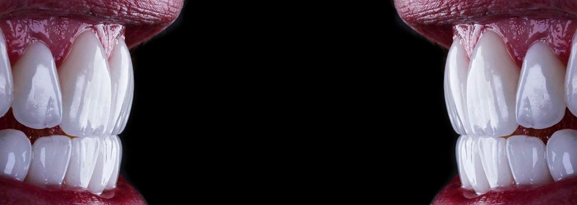 ΟΨΕΙΣ ΠΟΡΣΕΛΑΝΗΣ