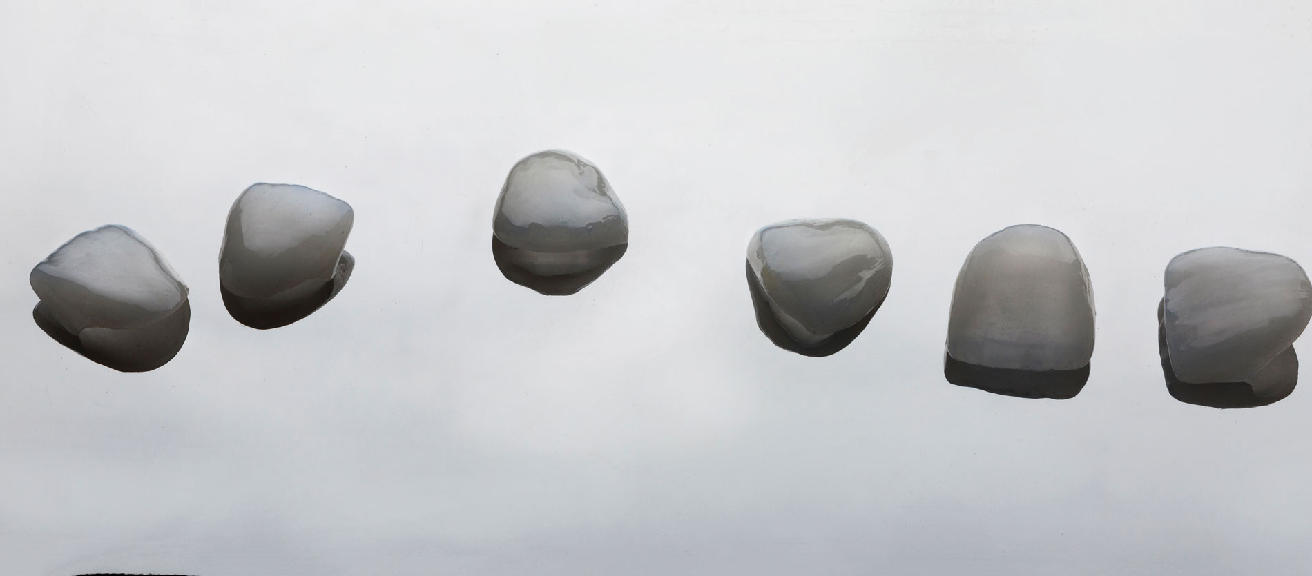 ΟΨΕΙΣ ΡΗΤΙΝΗΣ